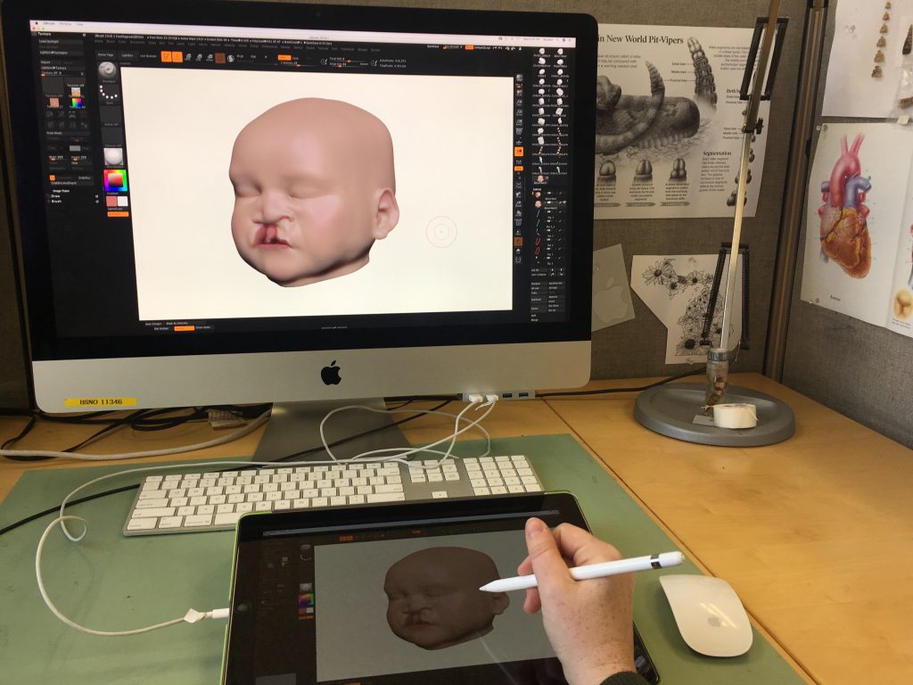 A detailed 3-D design of a baby with a cleft lip. 