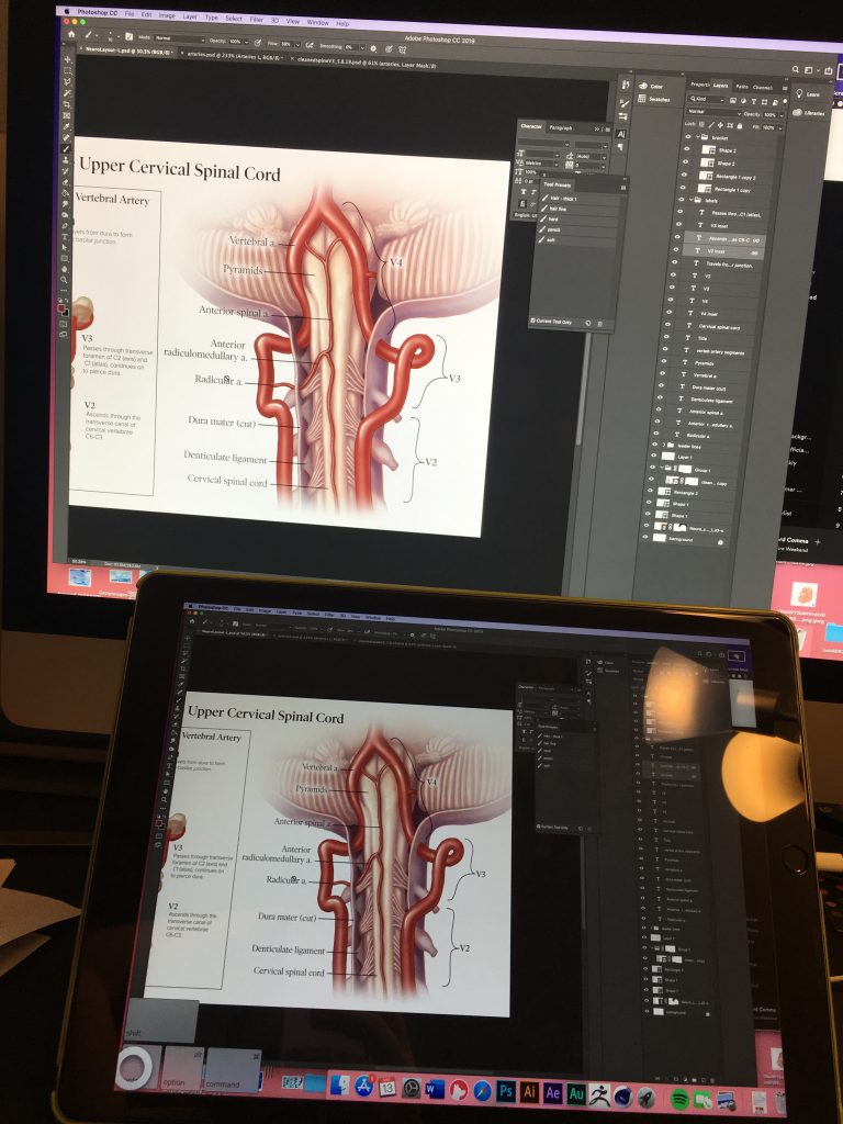 A detailed drawing of a spine opened in photoshop on both a tablet and computer. 